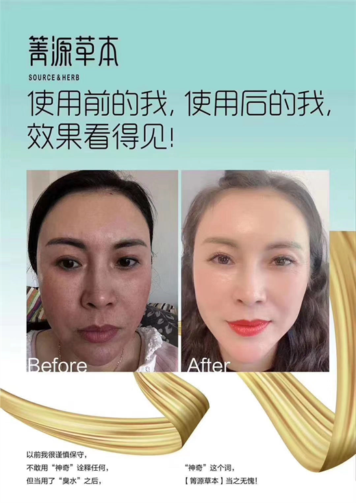 箐源草本臭水成分与功效