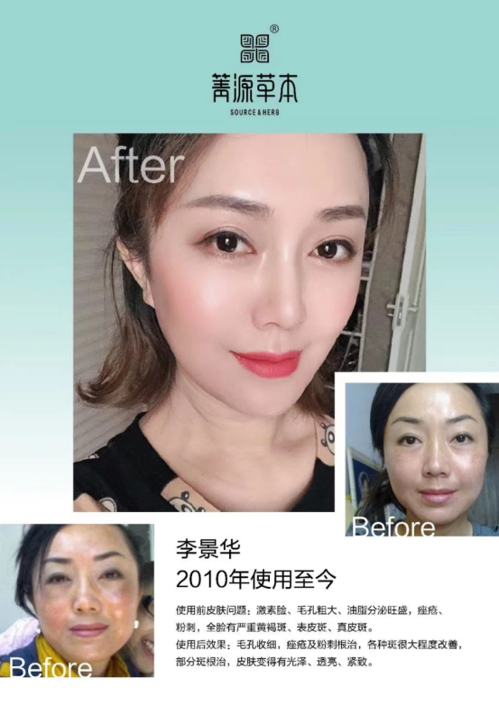 箐源草本臭水是微商产品吗?都有什么功效?