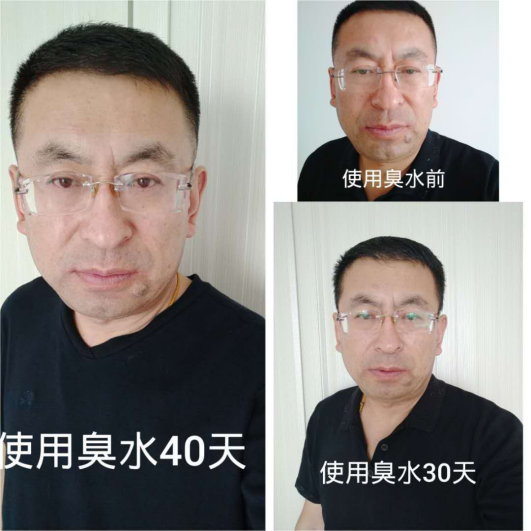箐源草本臭水是微商产品吗?都有什么功效?