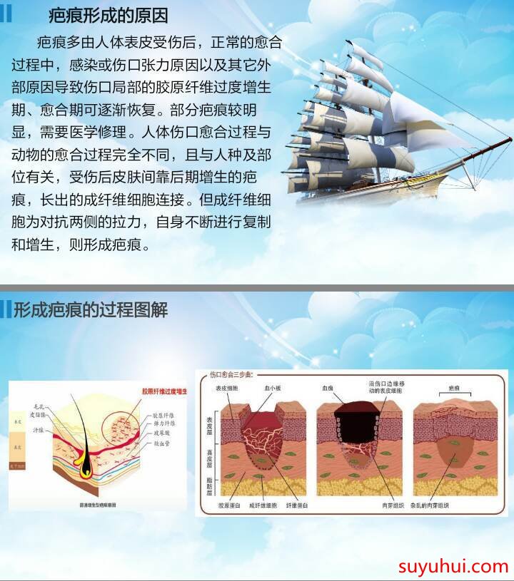 曼瑜天雅抚痕紧致霜成分功效及使用方法