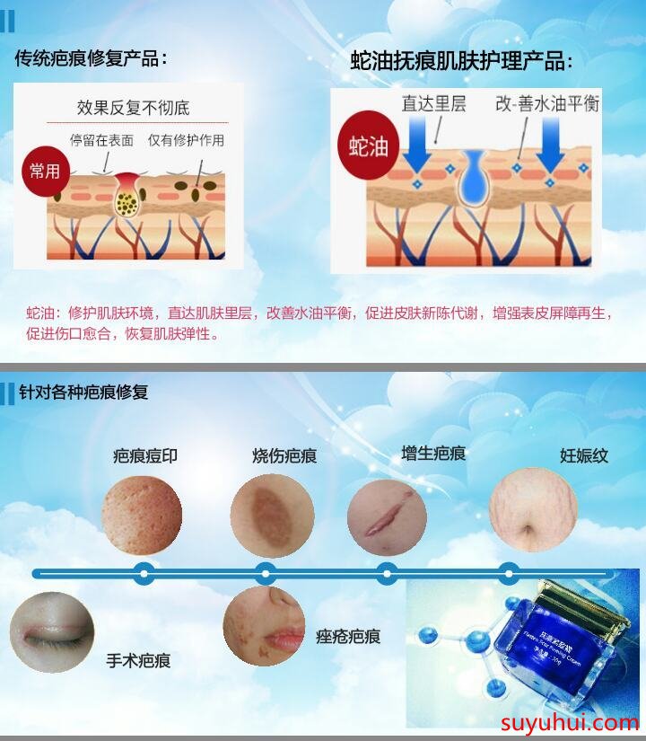曼瑜天雅抚痕紧致霜成分功效及使用方法